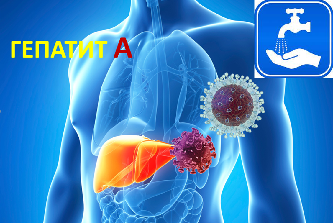 VIRAL HEPATITIS A (disease of dirty hands)