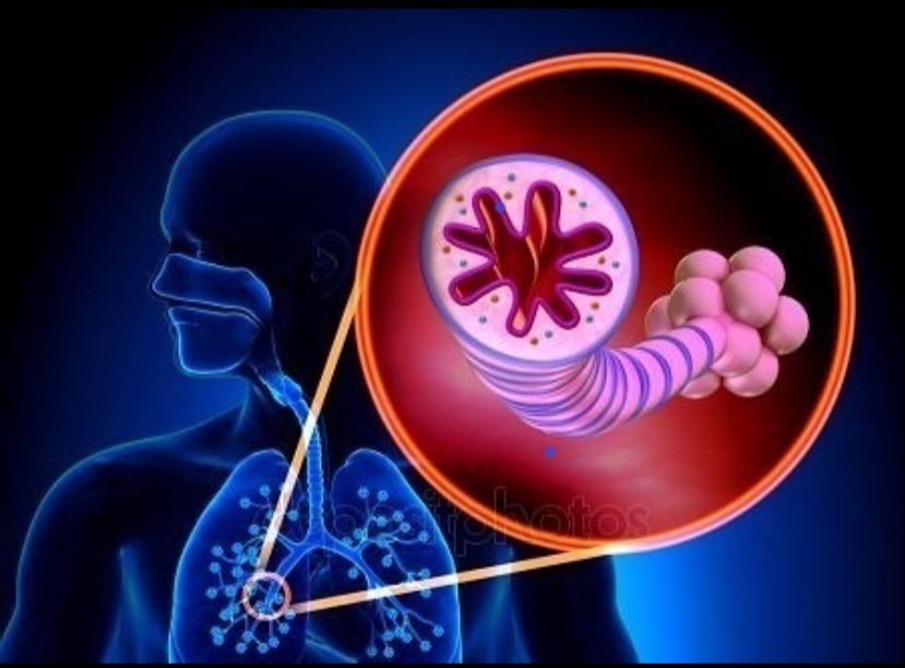 ДҮНИЕЖҮЗІЛІК БРОНХ ДЕМІКПЕСІМЕН КҮРЕС КҮНІ!