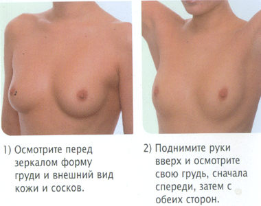 2017.01.30 Профилактика рака молочной железы ЦФЗОЖ 5