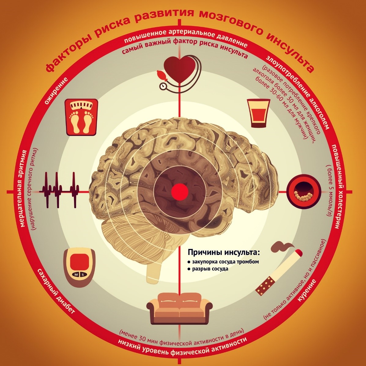 инсульттің қауіп факторлары.jpg