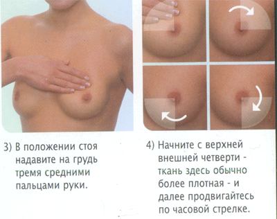 2017.01.30 Профилактика рака молочной железы ЦФЗОЖ 6