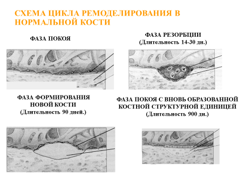 2016.07.08 Профилактика остеопороза 2