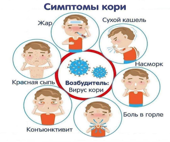 Симптомы кори.png