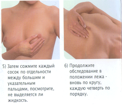 2017.01.30 Профилактика рака молочной железы ЦФЗОЖ 7