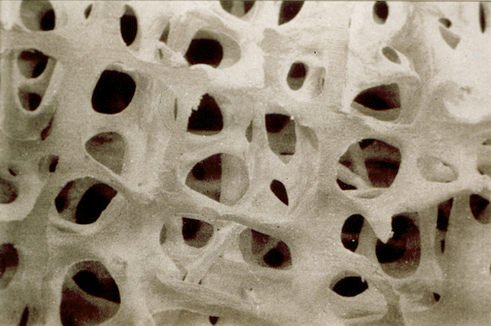 2016.07.08 Профилактика остеопороза 3